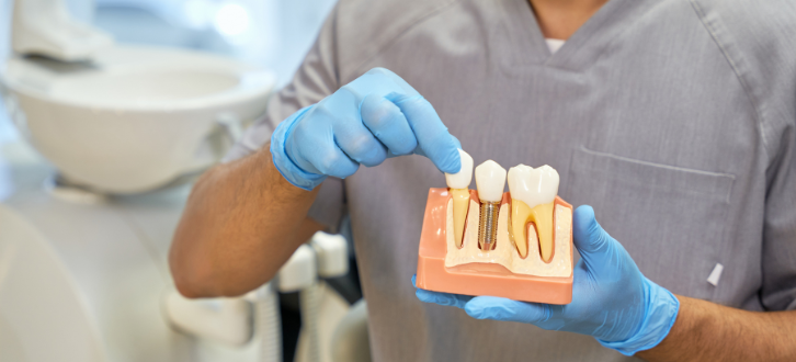 Dental implants